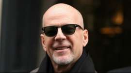 Bald Hollywood Actors